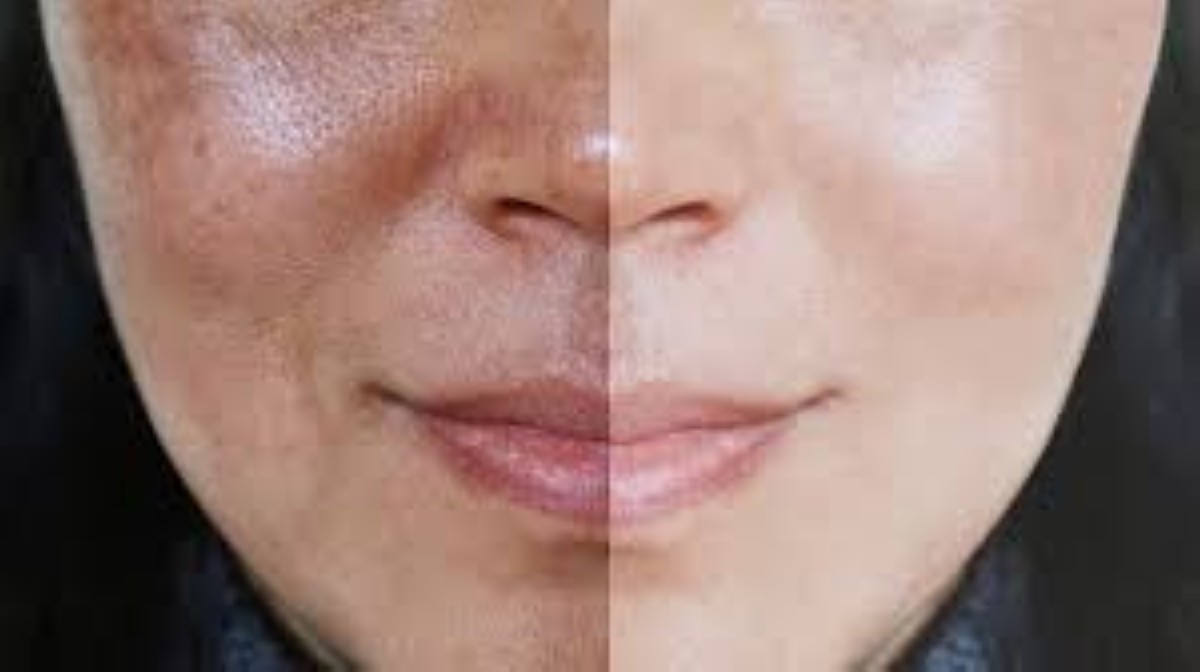 Sun damage vs. natural aging: Key differences and how to protect your skin