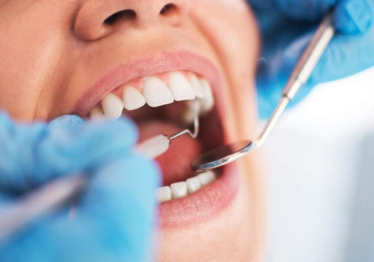 Menopause can trigger dental issues, but you can protect your mouth