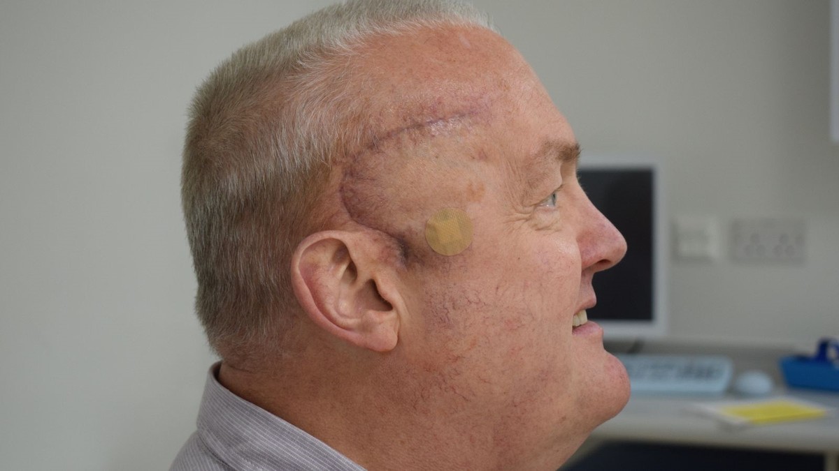 New British cancer treatment trial shrinks brain tumor by half