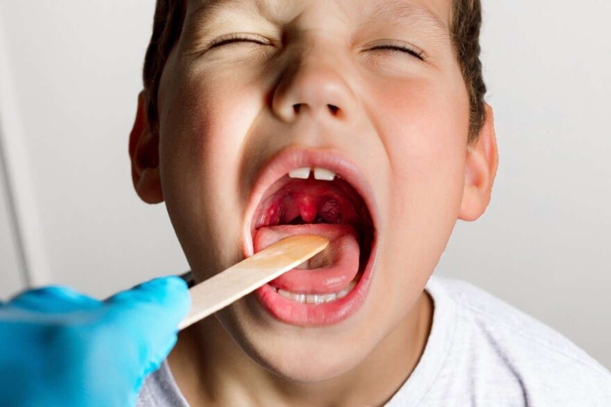 Removing tonsils as a child could have long-term effects