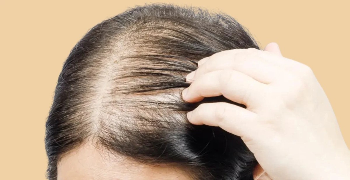 Solve your hair loss mystery with this easy 3-step pull test