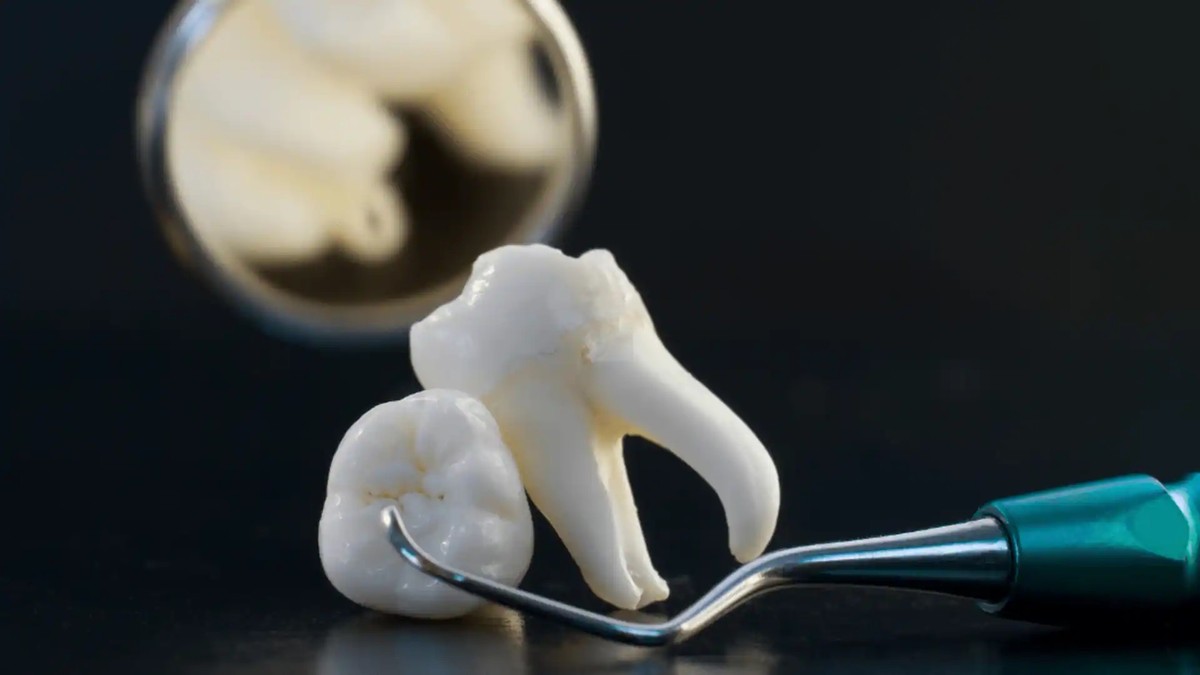 Scientists grow human teeth in the lab for the first time