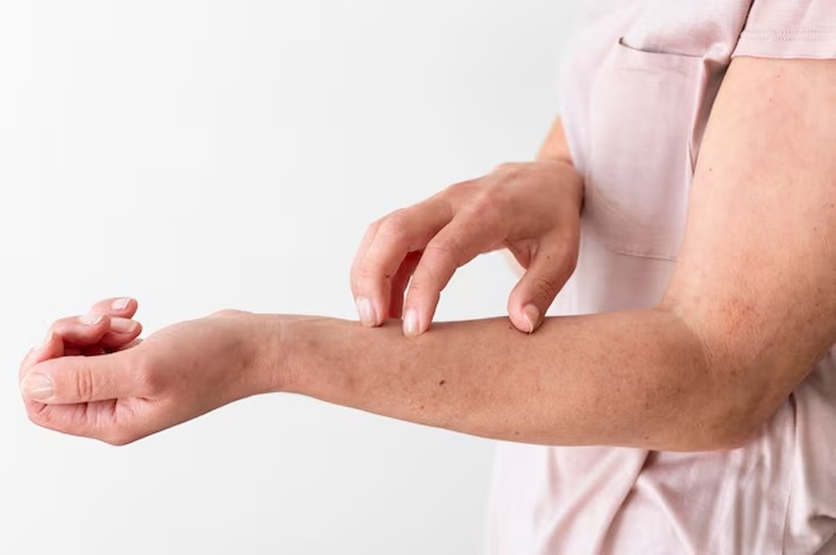 FDA warns of severe itching linked to common allergy medications