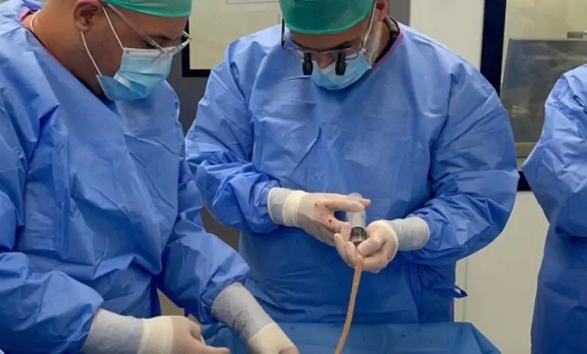 Kuwait performs Gulf&rsquo;s first arterial bypass using bovine biograft