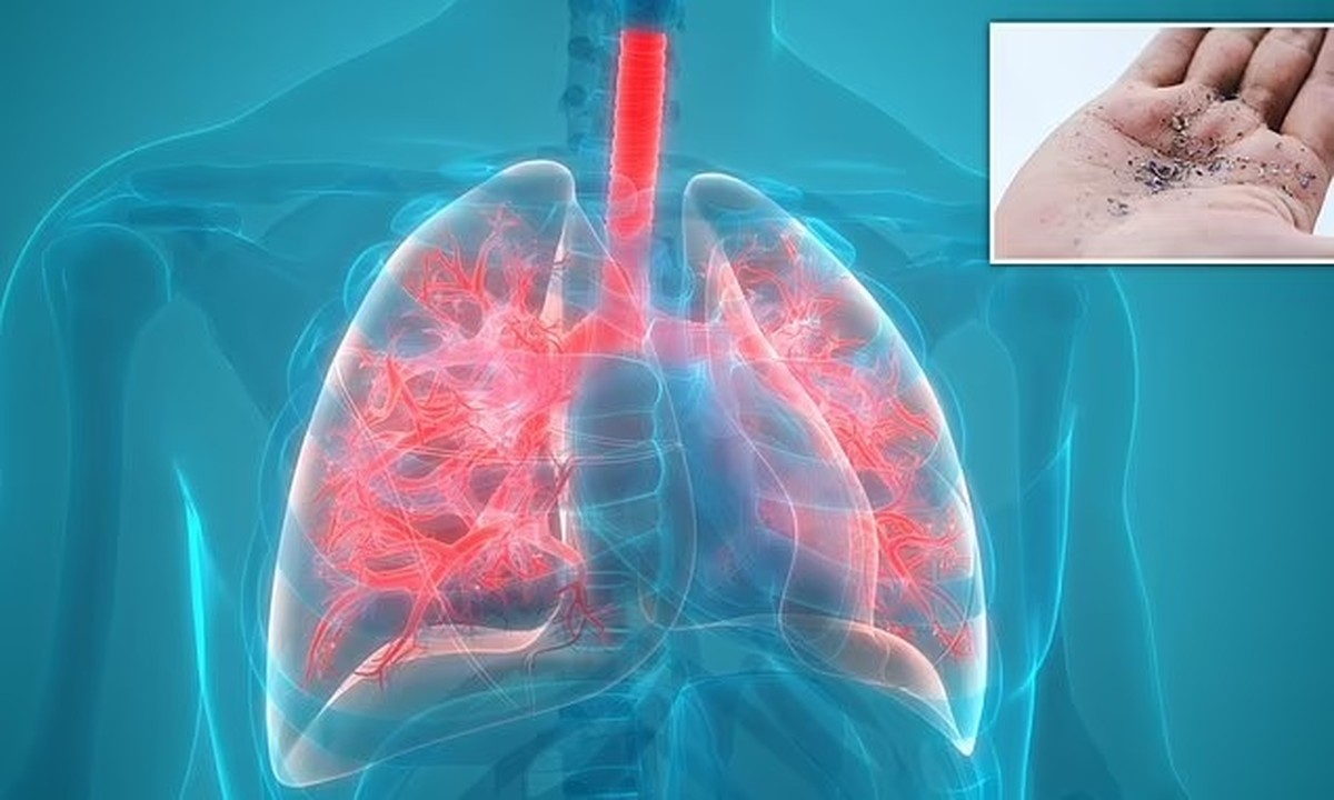 Are your plastic containers putting you at risk for lung cancer?