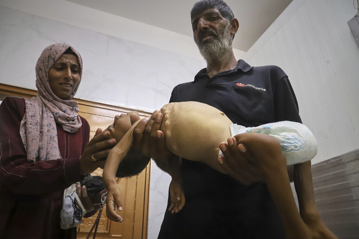 Skeletal Children in Gaza Contradict Netanyahu&rsquo;s &lsquo;No Starvation&rsquo; Stance