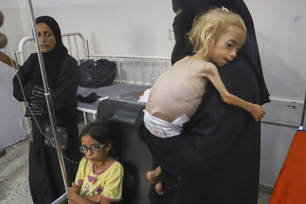 Skeletal Children in Gaza Contradict Netanyahu&rsquo;s &lsquo;No Starvation&rsquo; Stance