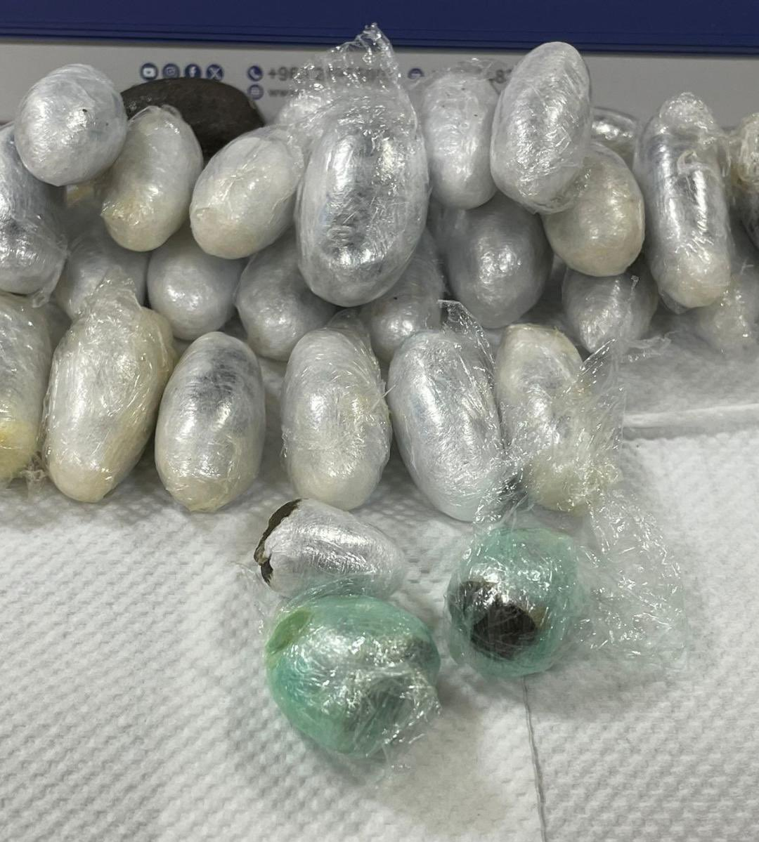 European Drug Mule Caught At Kuwait Airport With Hashish Hidden In His Stomach