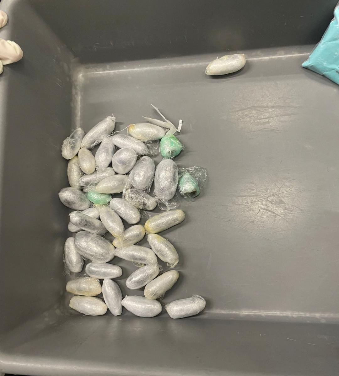 European Drug Mule Caught At Kuwait Airport With Hashish Hidden In His Stomach