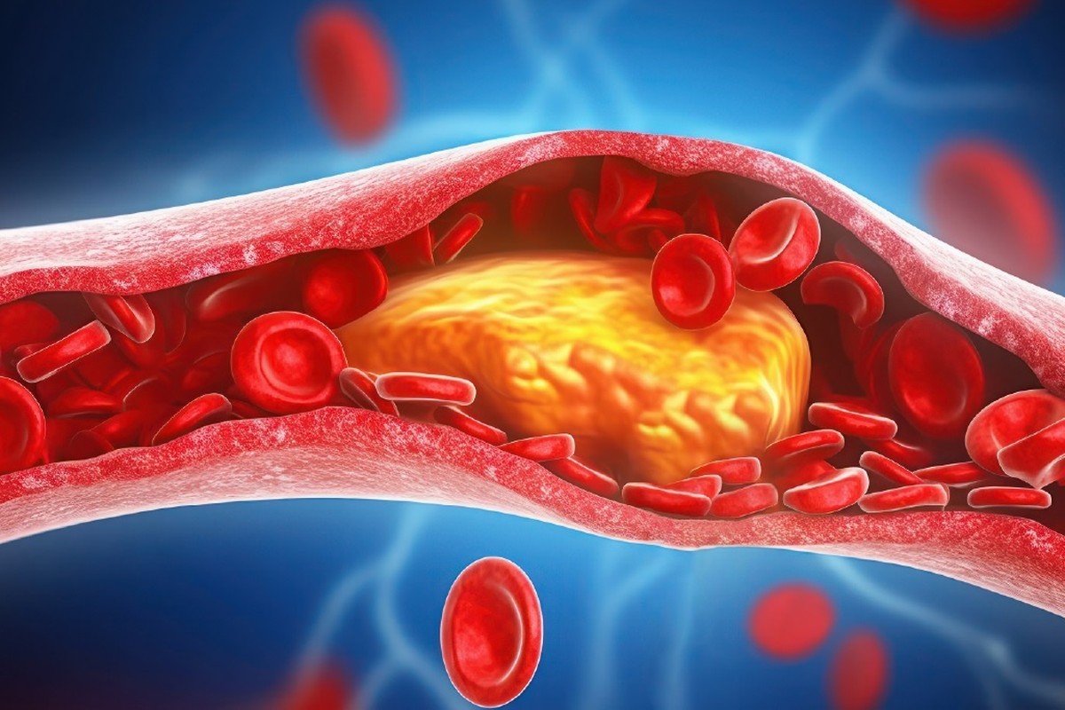 New study reveals cholesterol is more complex than 'good' or 'bad'