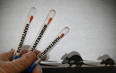 ‘Hantavirus’ risk remains low in Kuwait