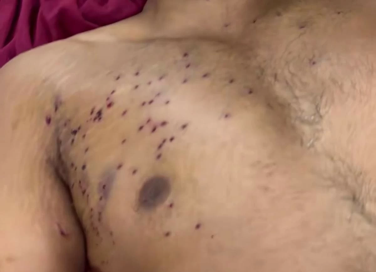 Reports Emerge Alleging Delhi Police Used Pellet Weapons Against Students During Protests; Home Ministry Faces Questions