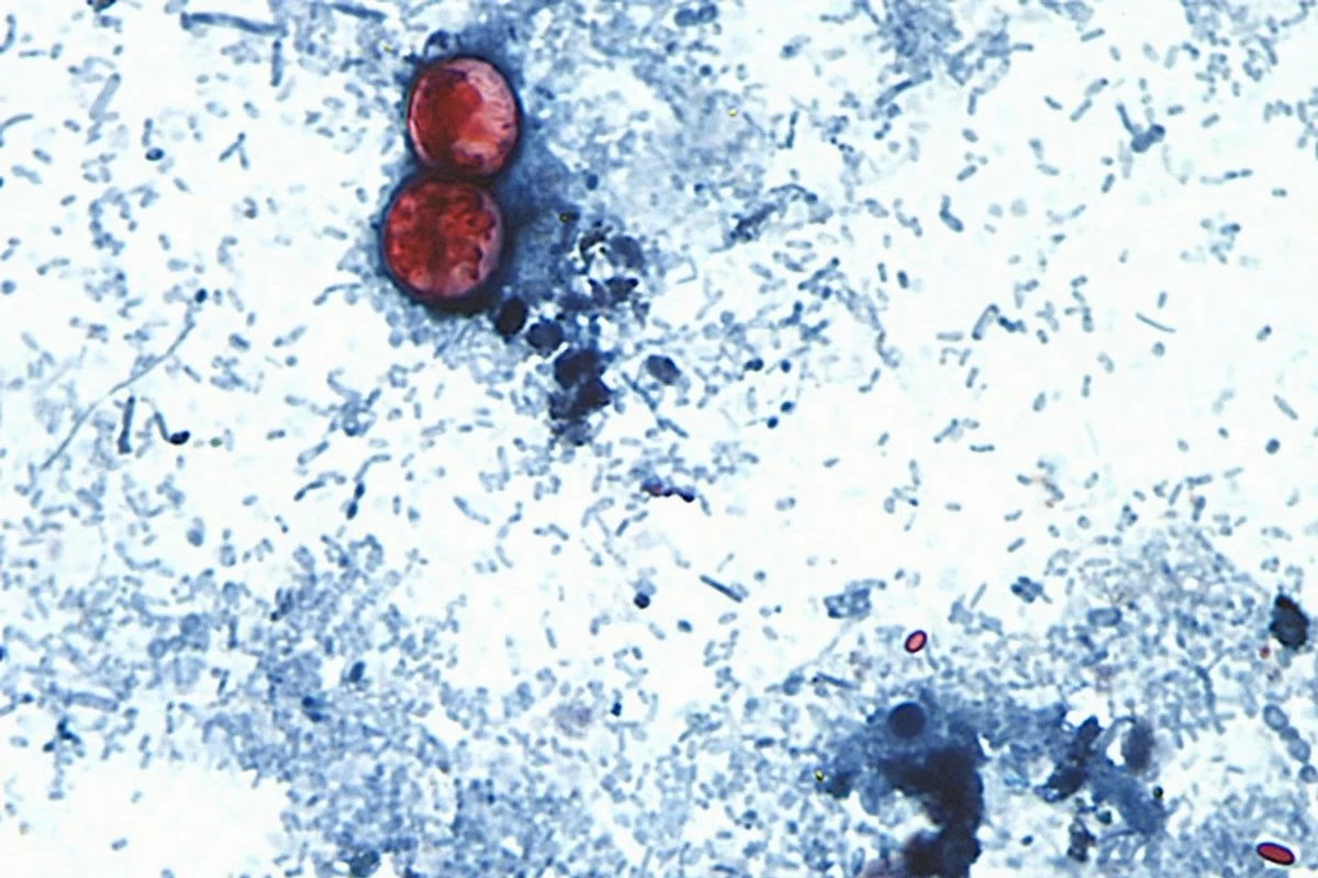 Michigan reports the first 2 US deaths related to diarrhea-causing parasite