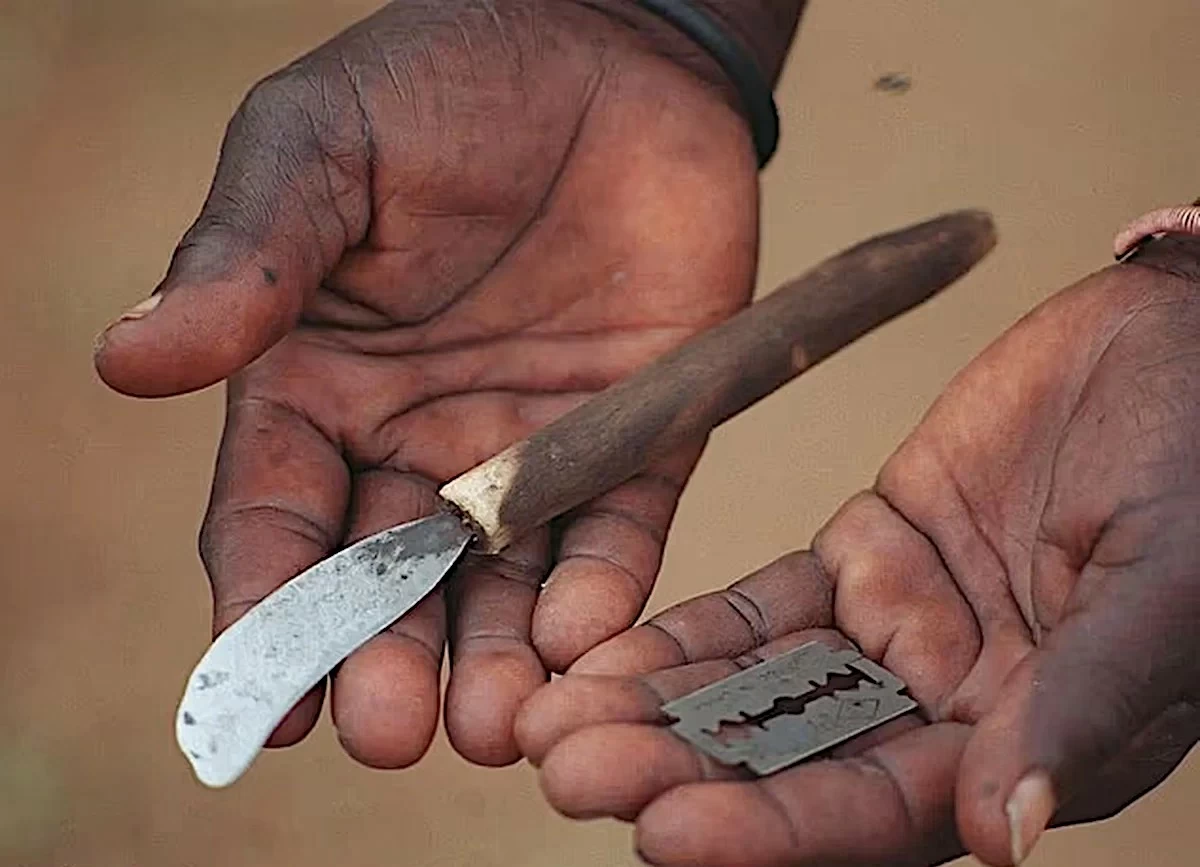 43 Boys Die in South Africa&rsquo;s Deadly Traditional Circumcision Rites