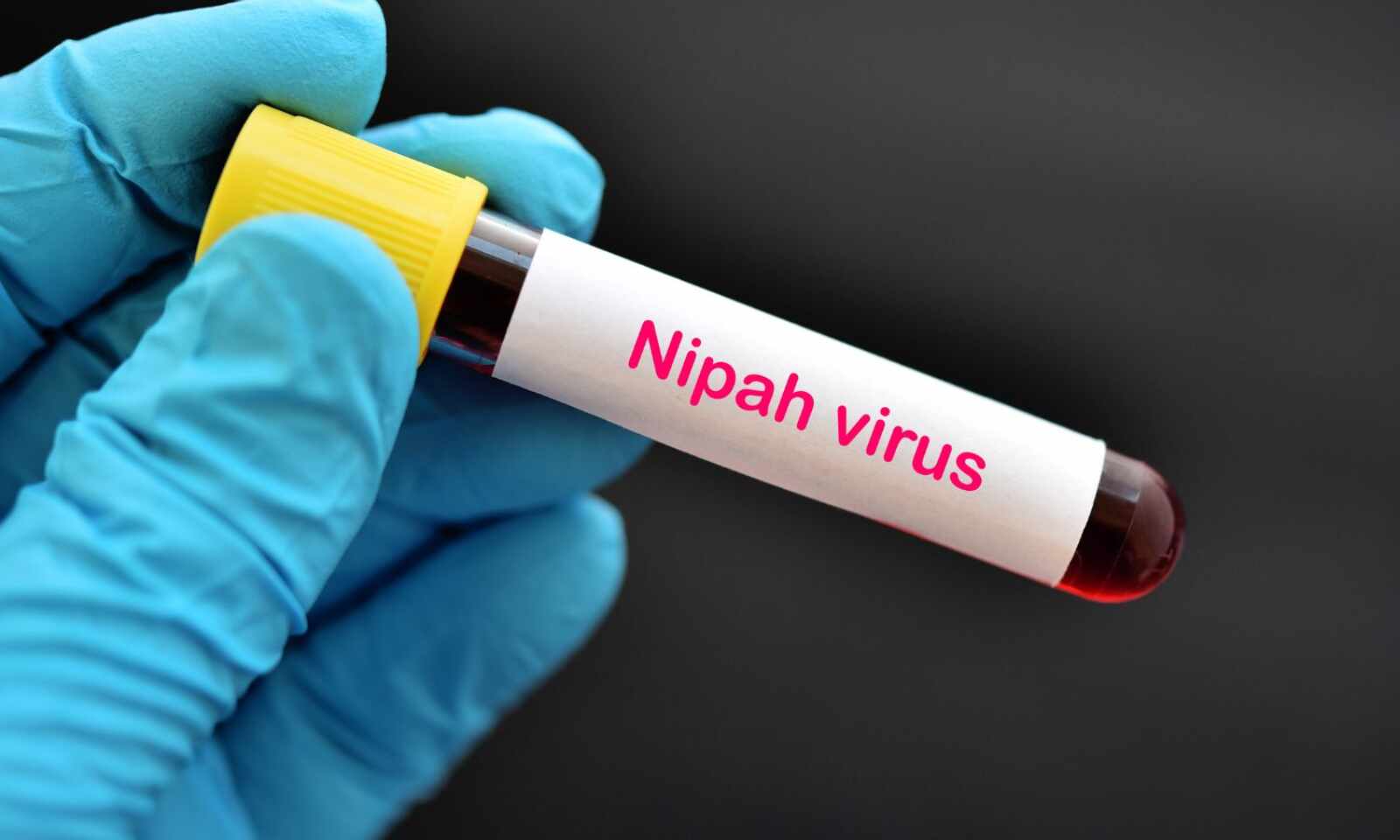 India on High Alert: Nipah Virus Cases Rise in Kerala