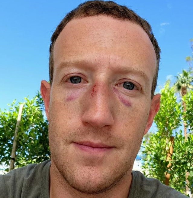 Zuckerberg’s latest Instagram post: Two black eyes and a sense of humor
