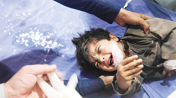 A doctor treats a boy who was injured from an earthquake in Peshawar, Pakistan on Oct 26. A powerful 7.5-magnitude earthquake in northern Afghanistan rocked cities across South Asia. Strong tremors were felt in Kabul, New Delhi and Islamabad on Monday. In the Pakistani capital, walls swayed back and forth and people poured out of office buildings in panic, reciting verses from the Holy Quran. (AP)
