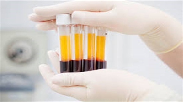 ‘Blood plasma injections with antibodies help avert corona’ | arabtimes