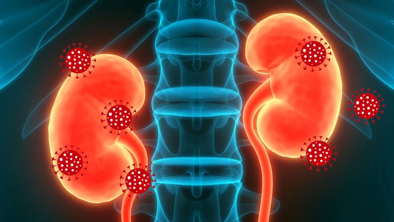 ‘COVID-hit kidney patients face risk’ - Death rate high